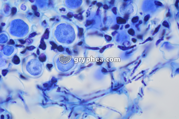 Lichen coupe du thalle montrant les algues unicellulaires et les filaments mycéliens x400 - gryphea.com